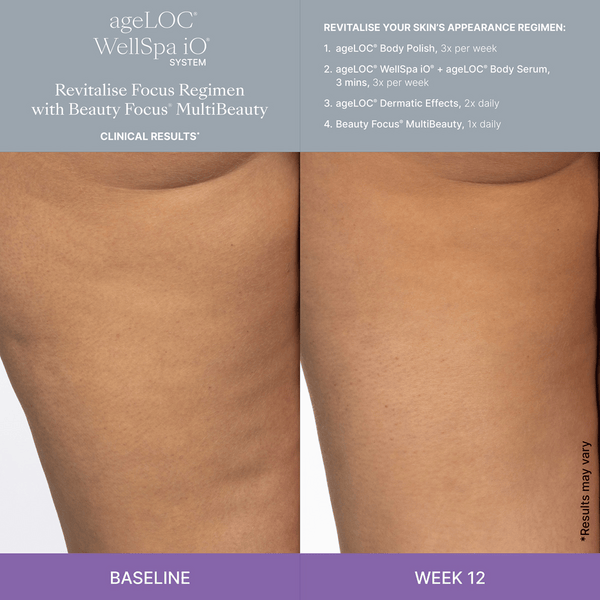 WellSpa-iO-MultiBeauty-Before-After-Images