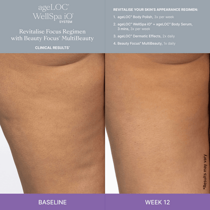 WellSpa-iO-MultiBeauty-Before-After-Images