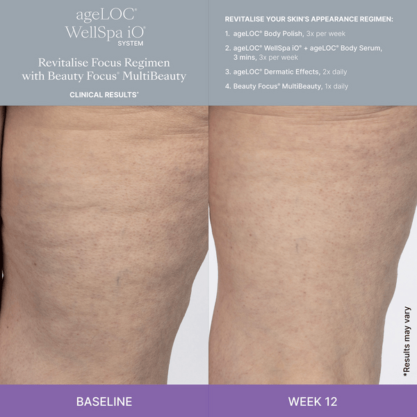 WellSpa-iO-MultiBeauty-Before-After-Images