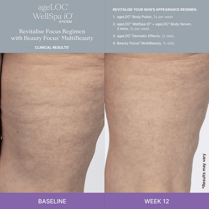 WellSpa-iO-MultiBeauty-Before-After-Images