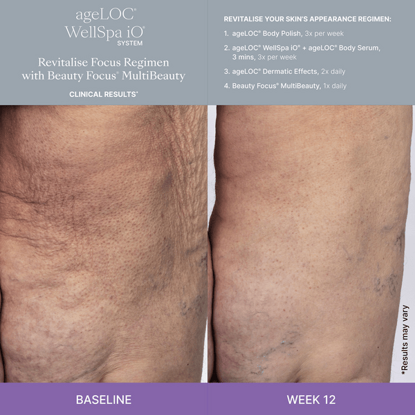 WellSpa-iO-MultiBeauty-Before-After-Images